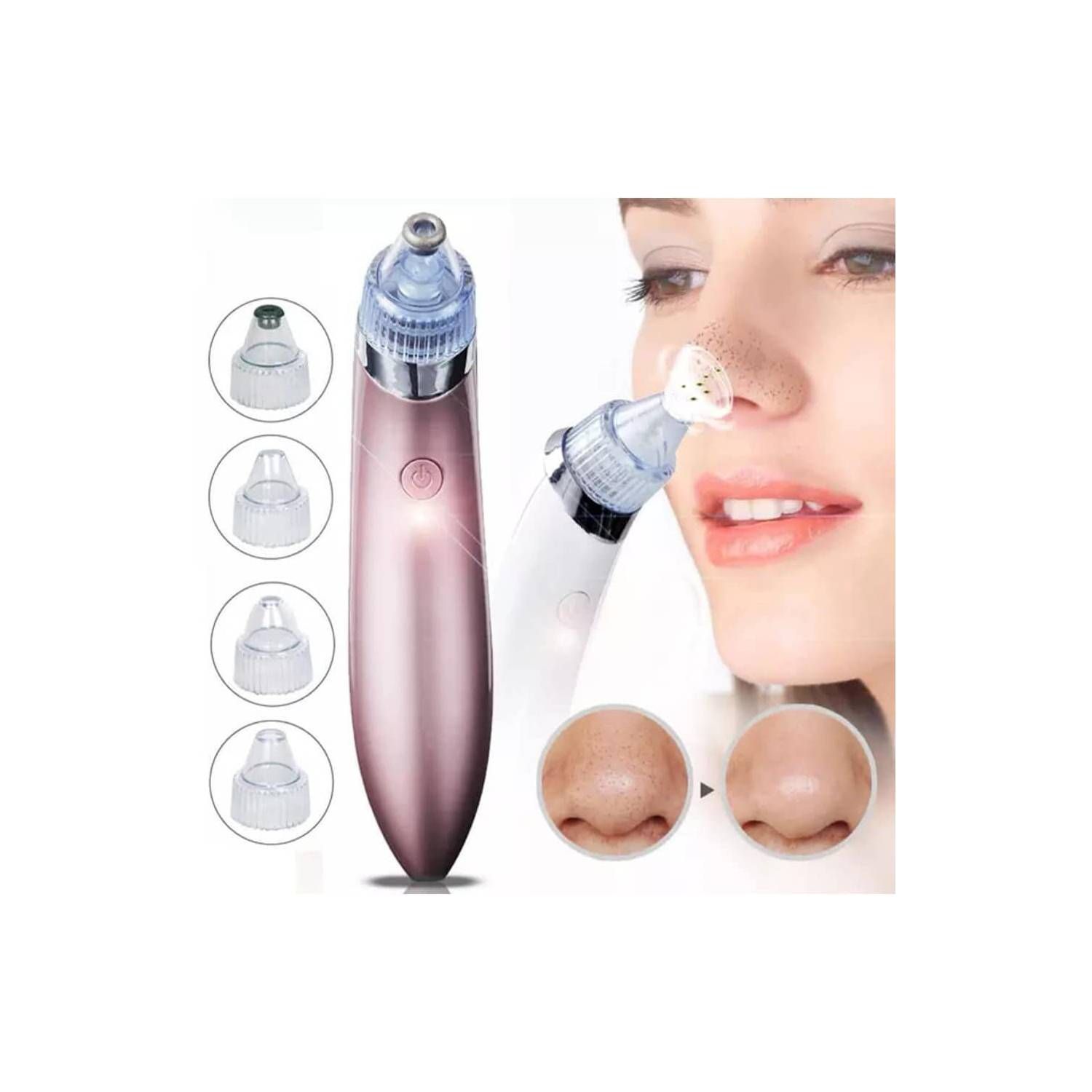 Limpiador Facial Extractor de Espinillas y Puntos Negros